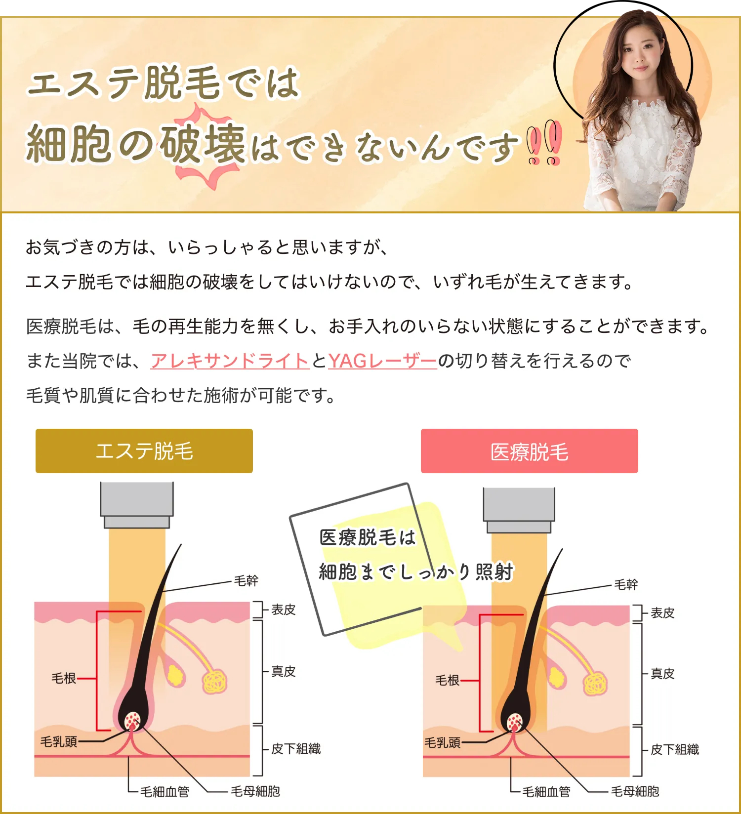 エステ脱毛では細胞の破壊はできないんです！お気づきの方は、いらっしゃると思いますが、エステ脱毛では細胞の破壊をしてはいけないのでいずれ毛が生えてきます。医療脱毛は、毛の再生能力を無くし、お手入れのいらない状態にすることができます。また当院では、アレキサンドライトとYAGレーザーの切り替えを行えるので毛質や肌質に合わせた施術が可能です。