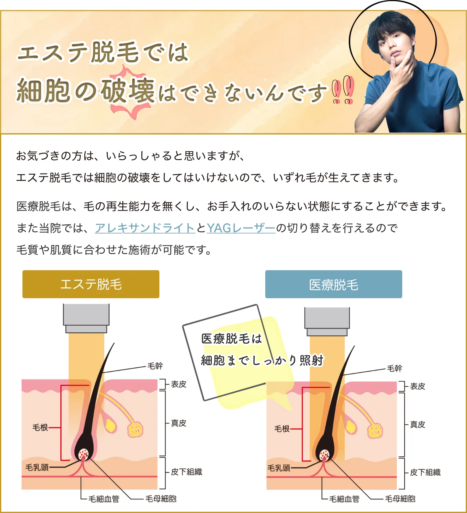 エステ脱毛では細胞の破壊はできないんです！お気づきの方は、いらっしゃると思いますが、エステ脱毛では細胞の破壊をしてはいけないのでいずれ毛が生えてきます。医療脱毛は、毛の再生能力を無くし、お手入れのいらない状態にすることができます。また当院では、アレキサンドライトとYAGレーザーの切り替えを行えるので毛質や肌質に合わせた施術が可能です。